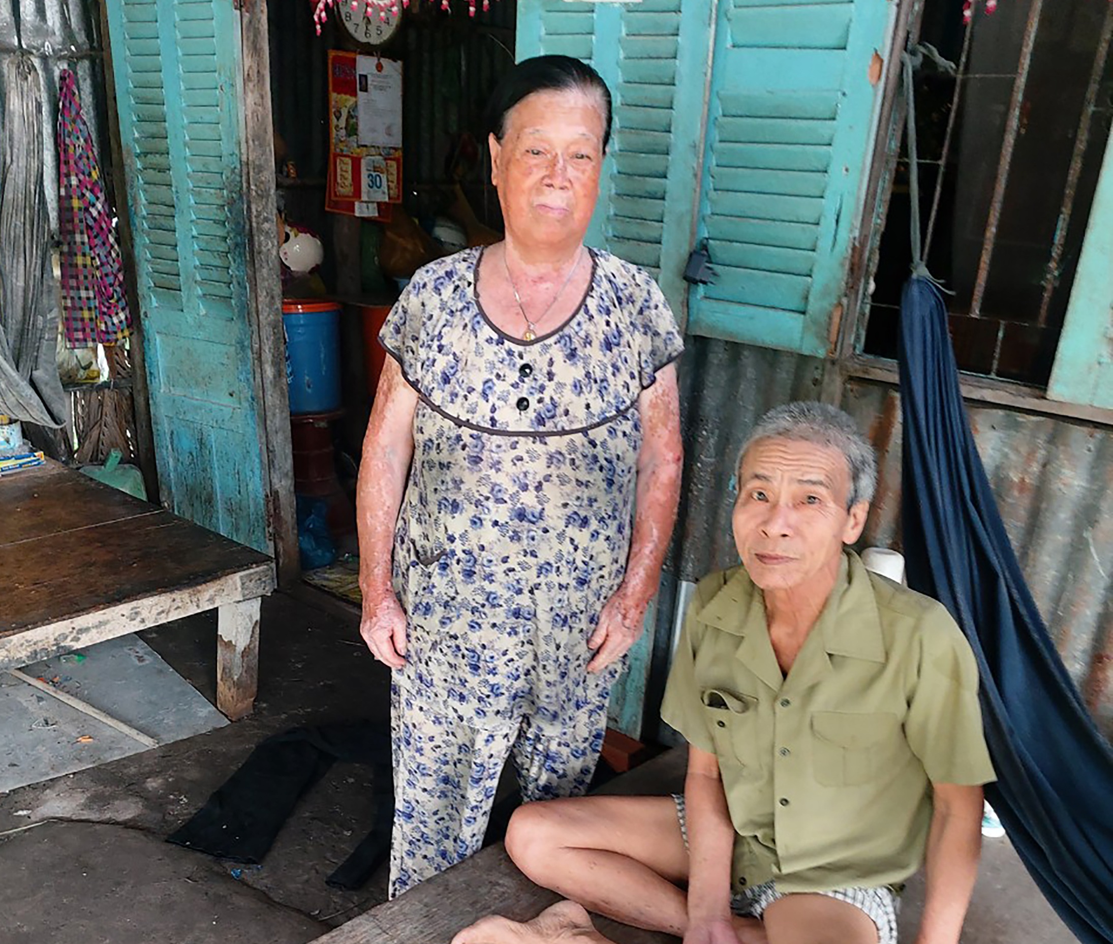 Cựu chiến binh bị tai biến mong được giúp đỡ